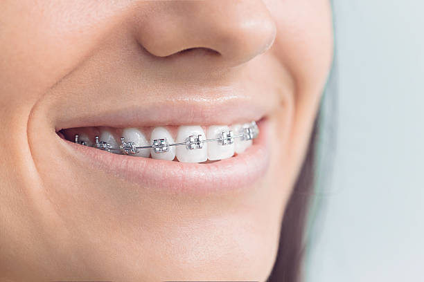 Full Mouth Reconstruction in Baxter, TN